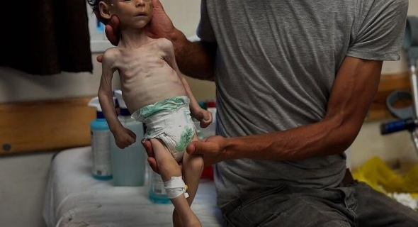 11 حالة وفاة جديدة نتيجة المجاعة بغزة خلال 24 ساعة