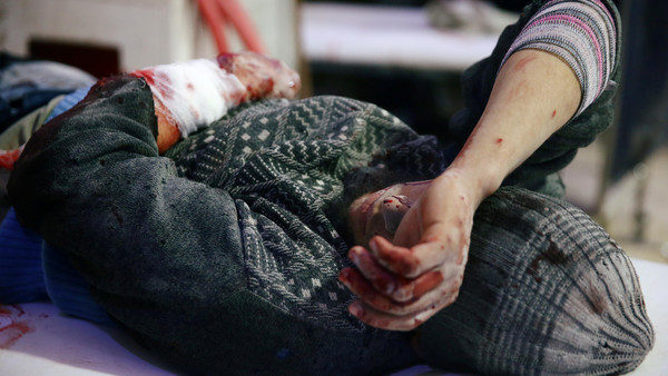 ATTENTION EDITORS - VISUAL COVERAGE OF SCENES OF INJURY OR DEATH An injured man is seen at a medical point in the besieged town of Douma, Eastern Ghouta, Damascus, Syria February 20, 2018. REUTERS/Bassam Khabieh TEMPLATE OUT TPX IMAGES OF THE DAY - RC14D4E4F920